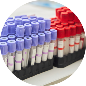 Blood_Samples_MolDX_CRO_Crop_V1D1